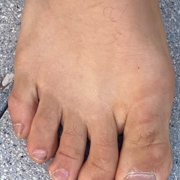 Miniature — gros plan d'un pied nu